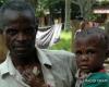 Se declara viruela simica en Kivu del Norte
