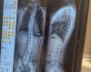 Acaba de abrir un centro de espalda en Loiret para patologías de la columna