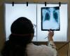 OMS: Nuevo récord mundial de casos de tuberculosis en 2023