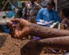 Mpox: ligera desaceleración de la contaminación en África