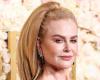 “¡Ella es la reina de las pelucas!” : este detalle físico en Nicole Kidman que enloquece a los internautas